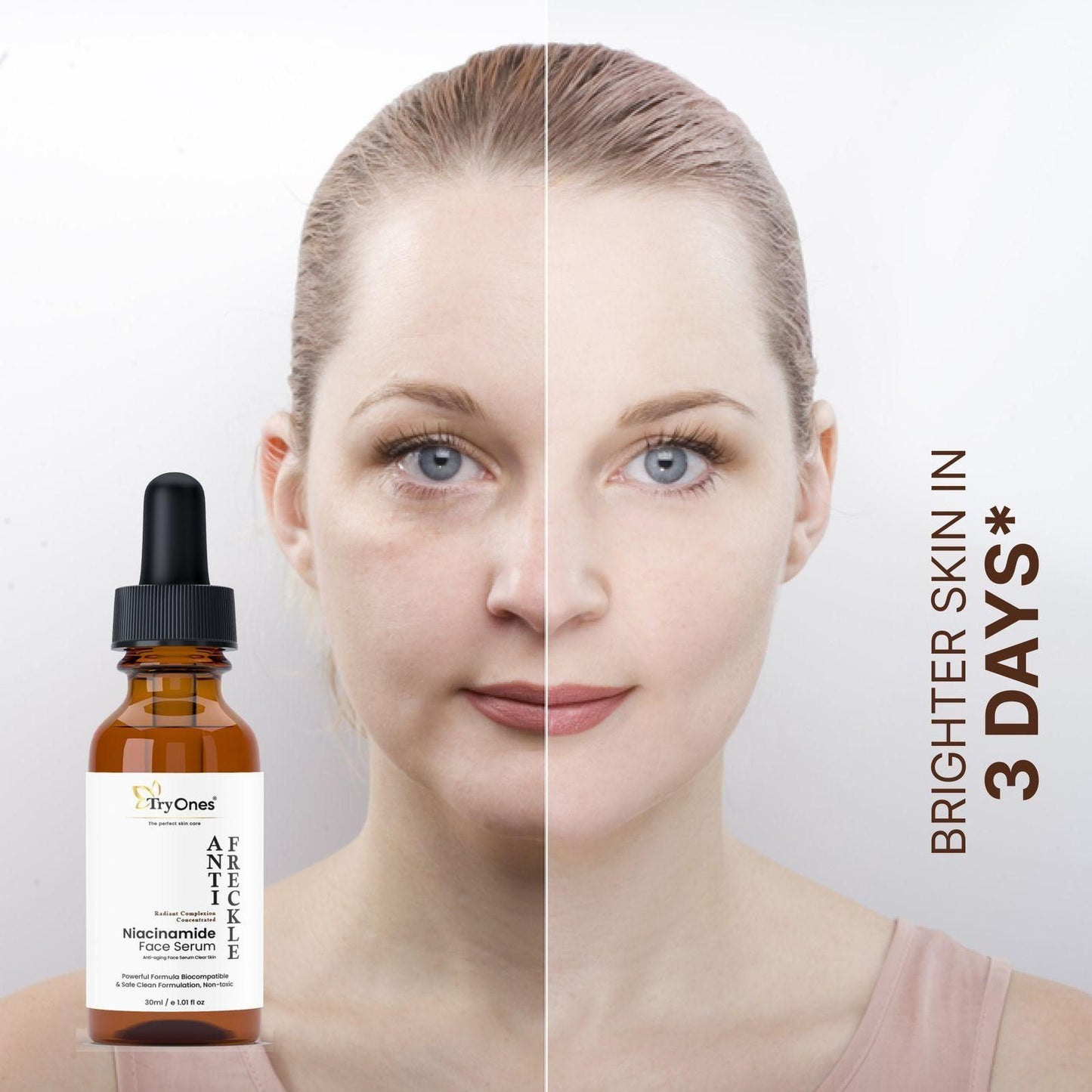 TryOnes Anti Freckle Niacinamide Face Serum 30ml – Spot Removal & Skin Brightening | NISHU Superstores