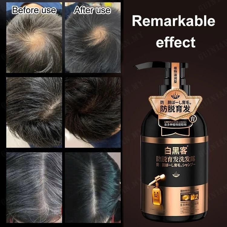 Anti-Hair Loss Shampoo 600ml (Pack of 2) – Hair Fall Control & Root Strengthening | NISHU Superstores