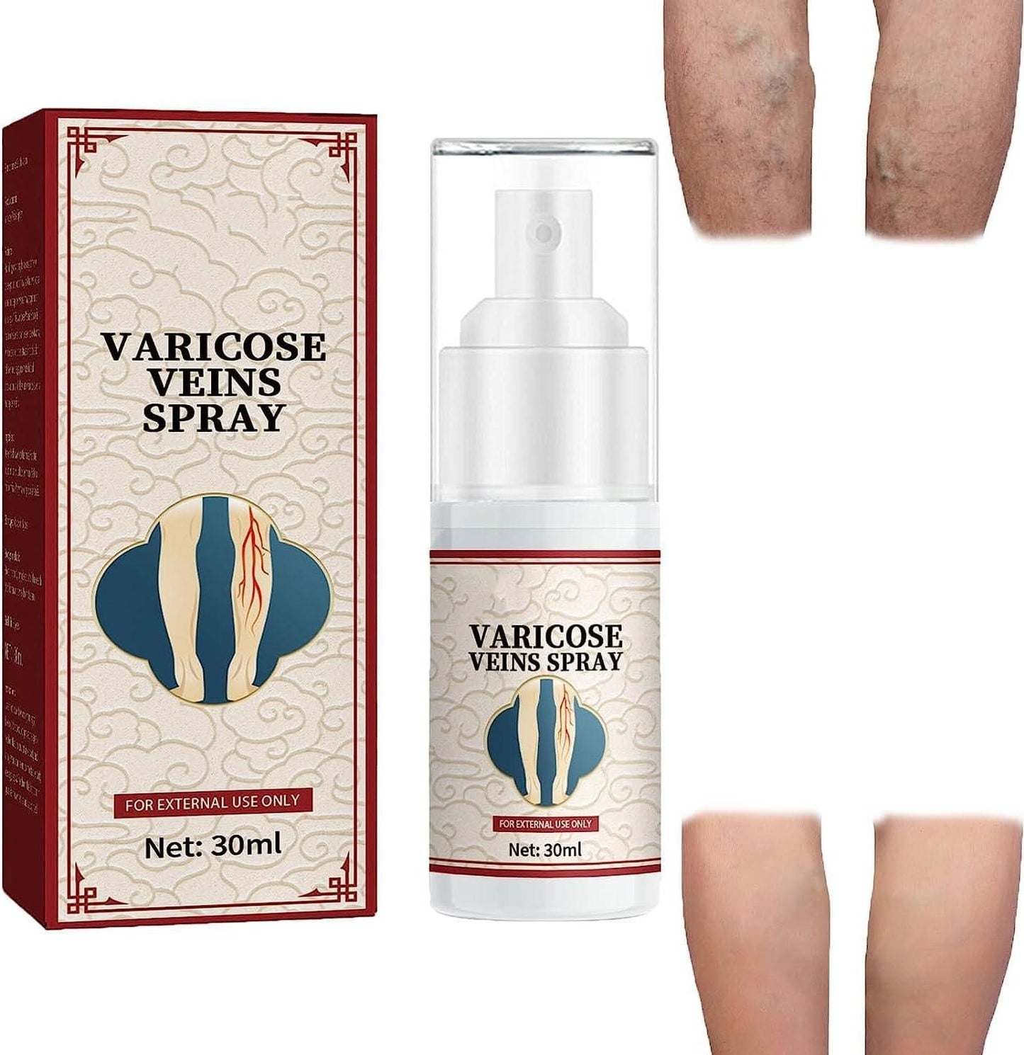 Vein Healing Varicose Veins Treatment Spray – Fast Relief for Leg Pain & Swelling | Pack of 1 | NISHU Superstores
