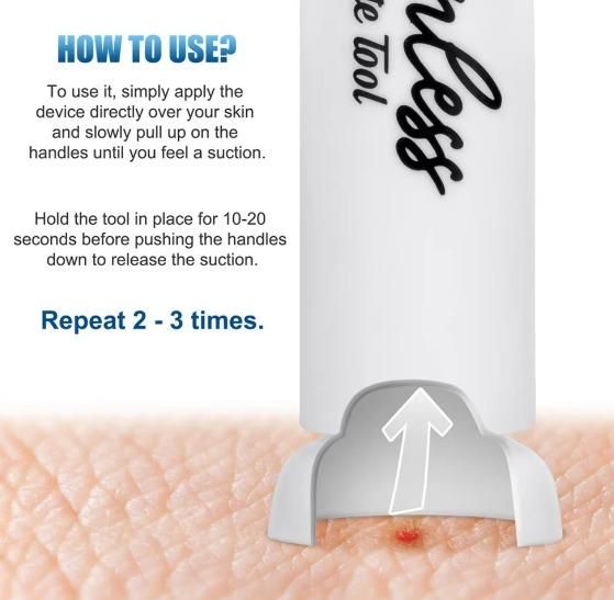 Bite Venom Extractor Pump for Mosquito & Insect Bites – First Aid Bug Bite Relief Tool | NISHU Superstores