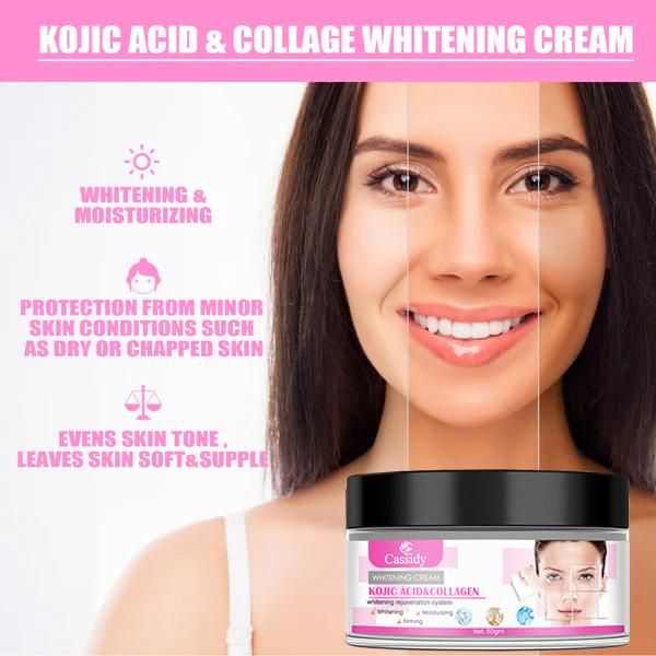 CASSIDY Kojic Acid & Collagen Whitening Cream 60gm – Brightening & Anti-Aging Skincare | NISHU Superstores