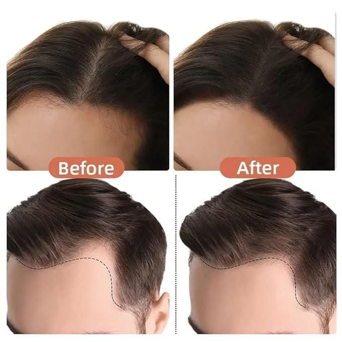 Natural Hair Shading Sponge Pen – Instant Hairline Filler & Root Touch-Up | NISHU Superstores