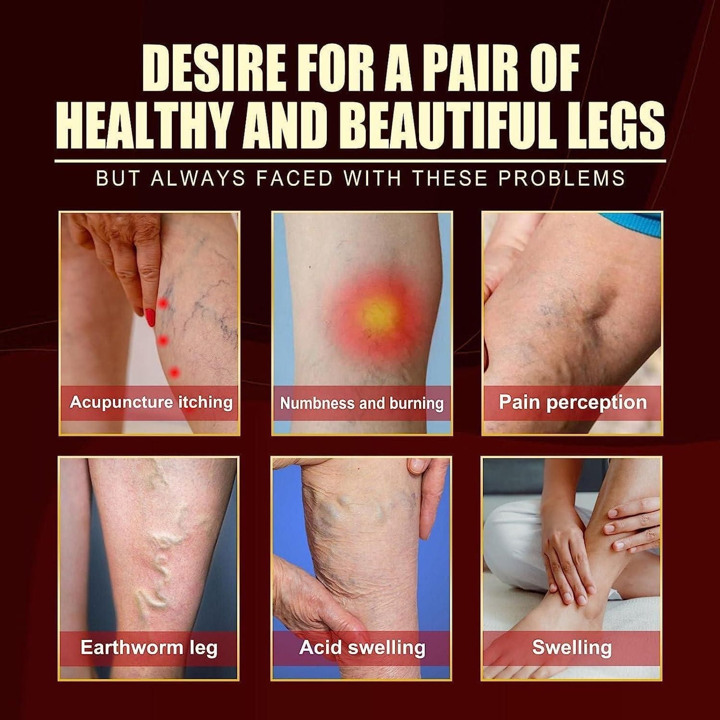 Vein Healing Varicose Veins Treatment Spray – Fast Relief for Leg Pain & Swelling | Pack of 1 | NISHU Superstores