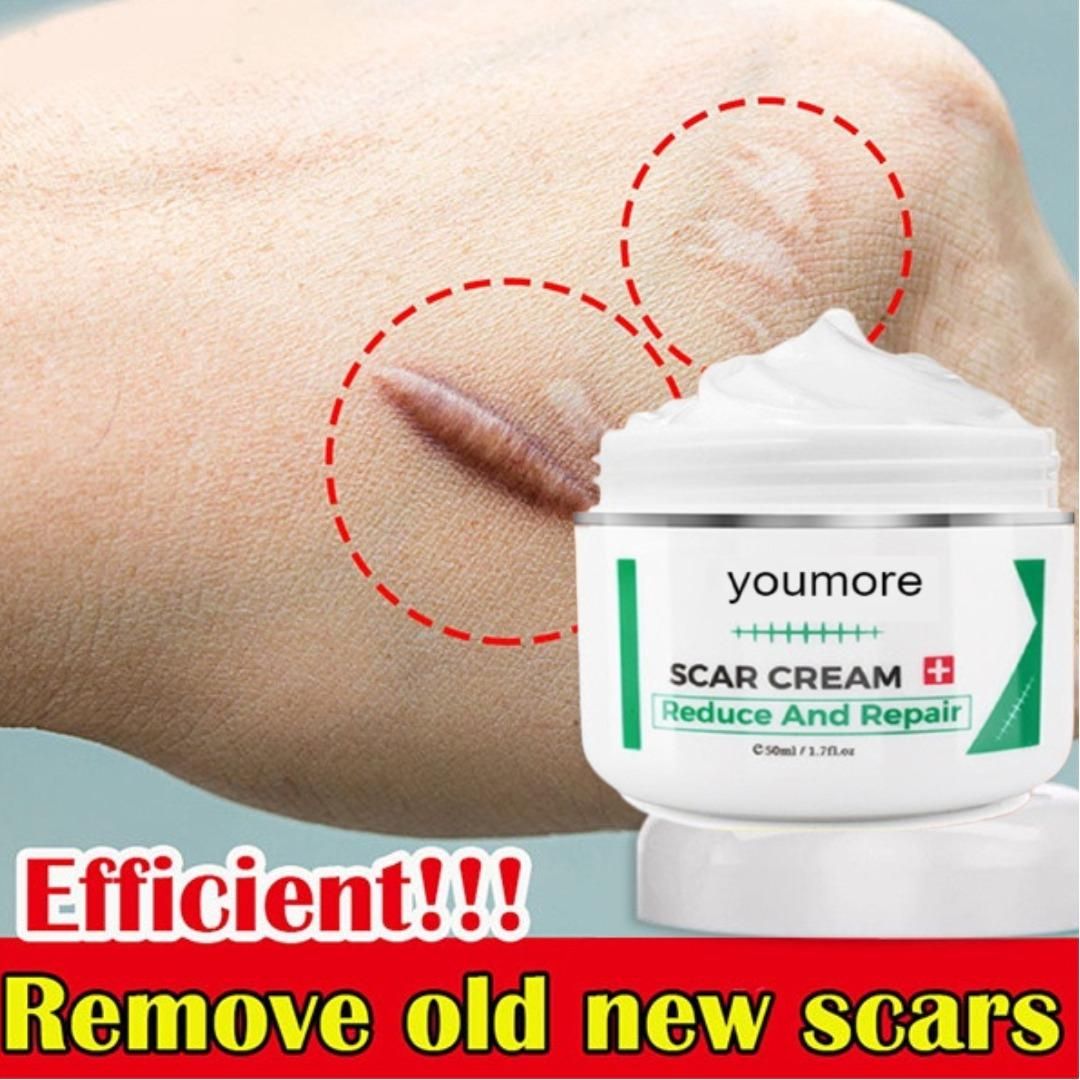 Scar Remover Stretch Mark Cream 50gm – Fade Scars & Stretch Marks Naturally | NISHU Superstores