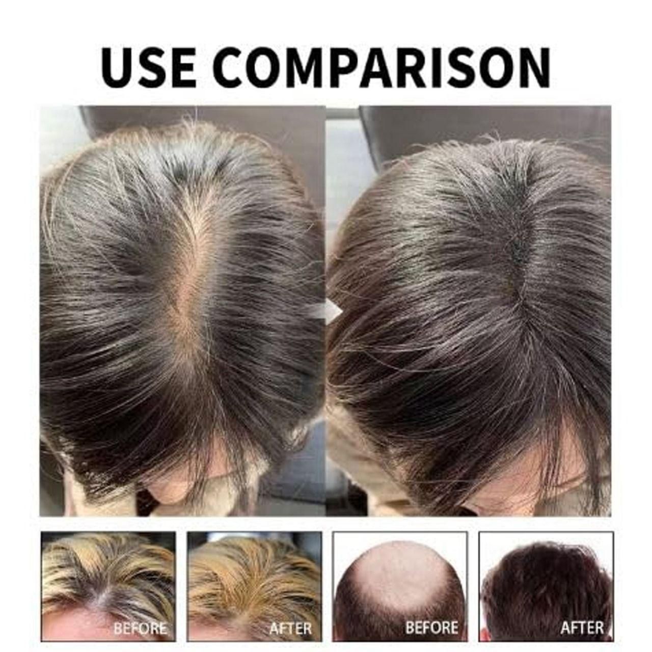 Hair Loss Treatment Serum 30ml (Pack of 2) – Boost Hair Growth & Strengthen Roots | NISHU Superstores
