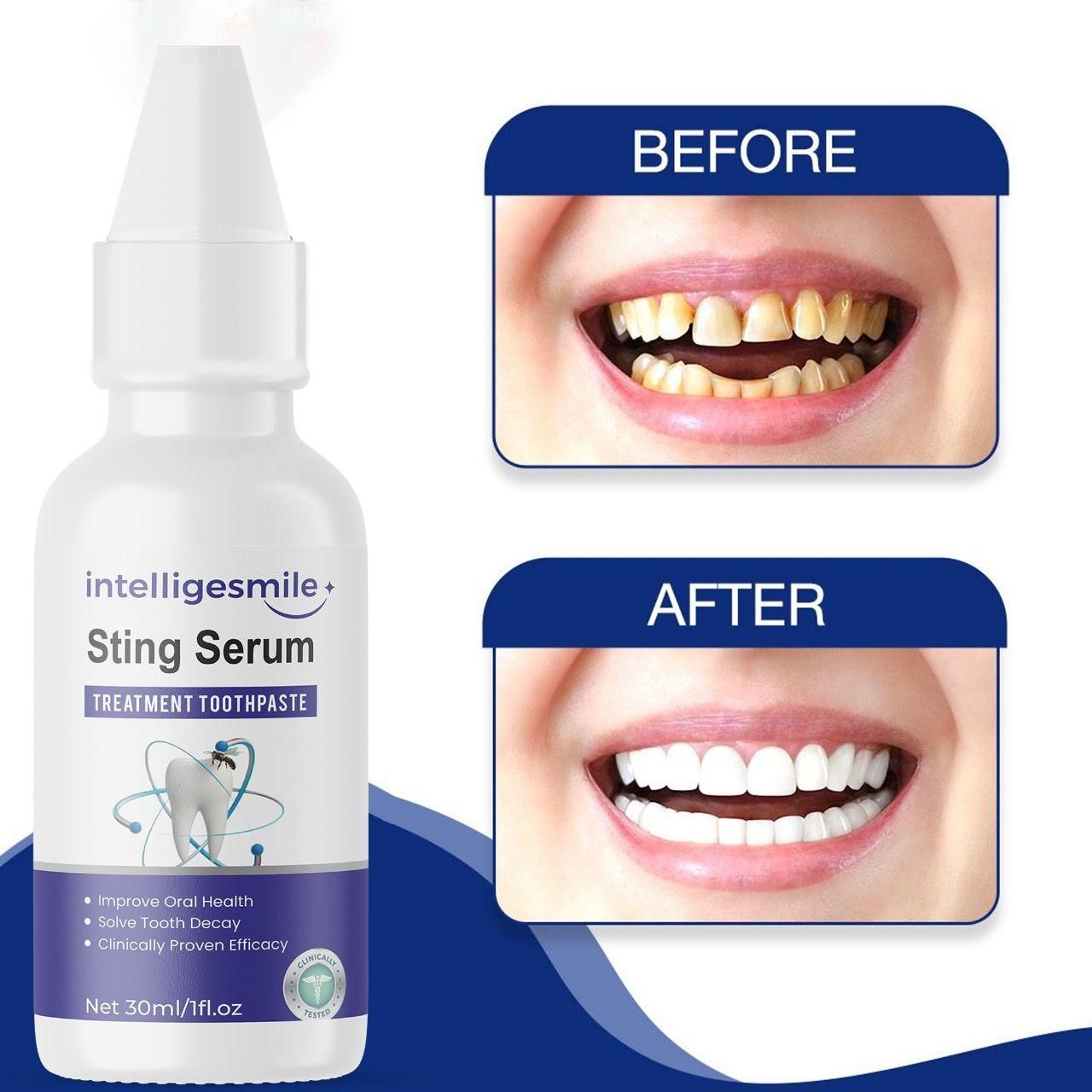 Intelligent smile Sting Serum Treatment Toothpaste 60ml (Pack of 2) – Advanced Oral Care | NISHU Superstores