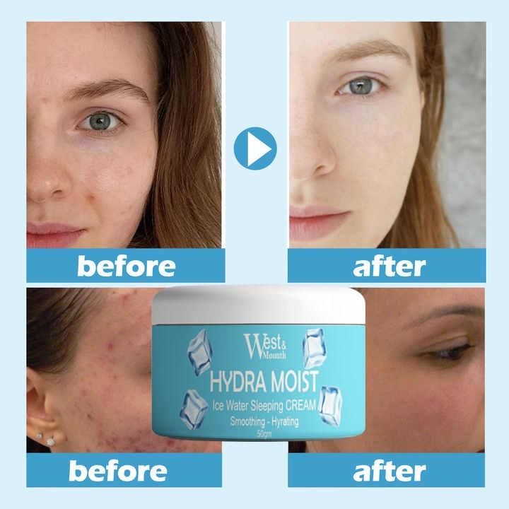 West & Mouth Hydra Moist Ice Water Sleeping Cream 100gm (Pack of 2) – Intense Overnight Hydration | NISHU Superstores