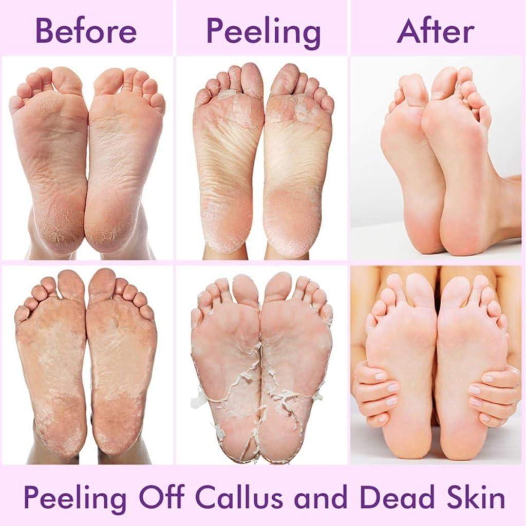 Exfoliating Foot Mask – Hydrating Sock Pedicure Essential for Soft & Smooth Feet | NISHU Superstores