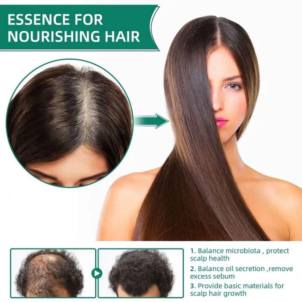Wets & Months Hair Growth Essence – 60ml (Pack of 1) | Anti Hair Loss & Regrowth Serum | NISHU Superstores