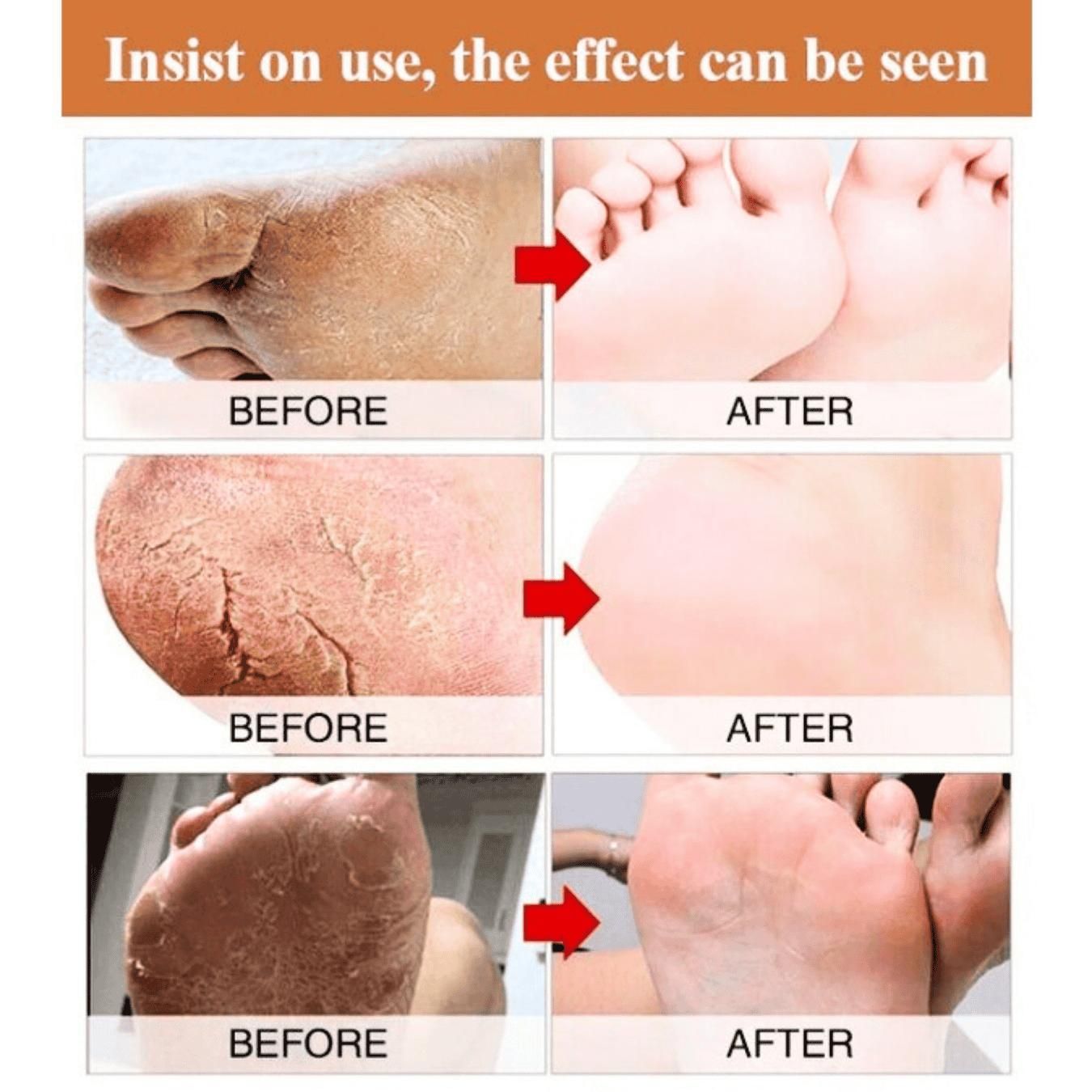 Foot Cream 200ml – Cracked Heel & Dry Skin Repair Balm | Intense Healing for Feet & Fingers | NISHU Superstores