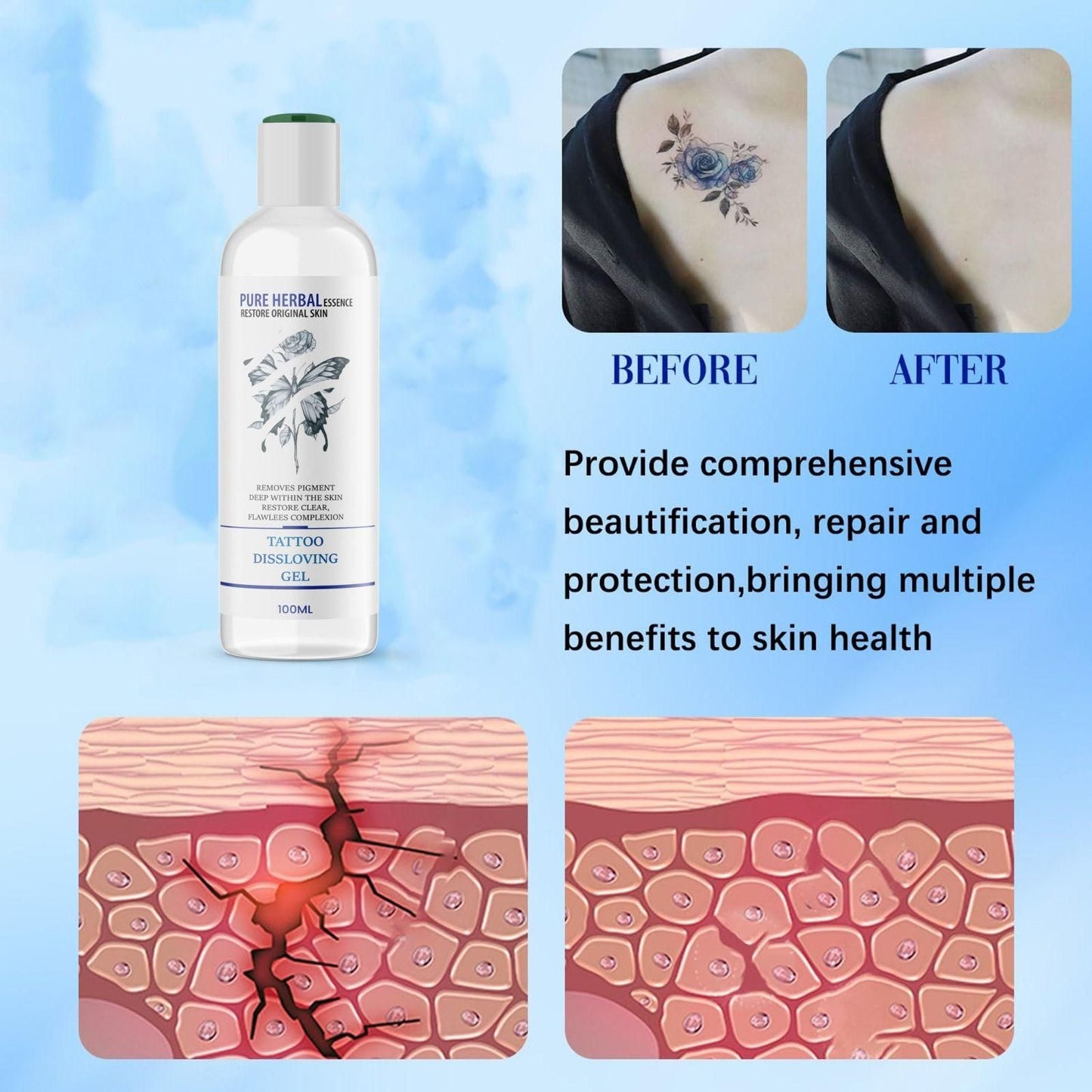 Tattoo Dissolving Gel 100ML (Pack of 2) – Effective & Safe Tattoo Removal | NISHU Superstores