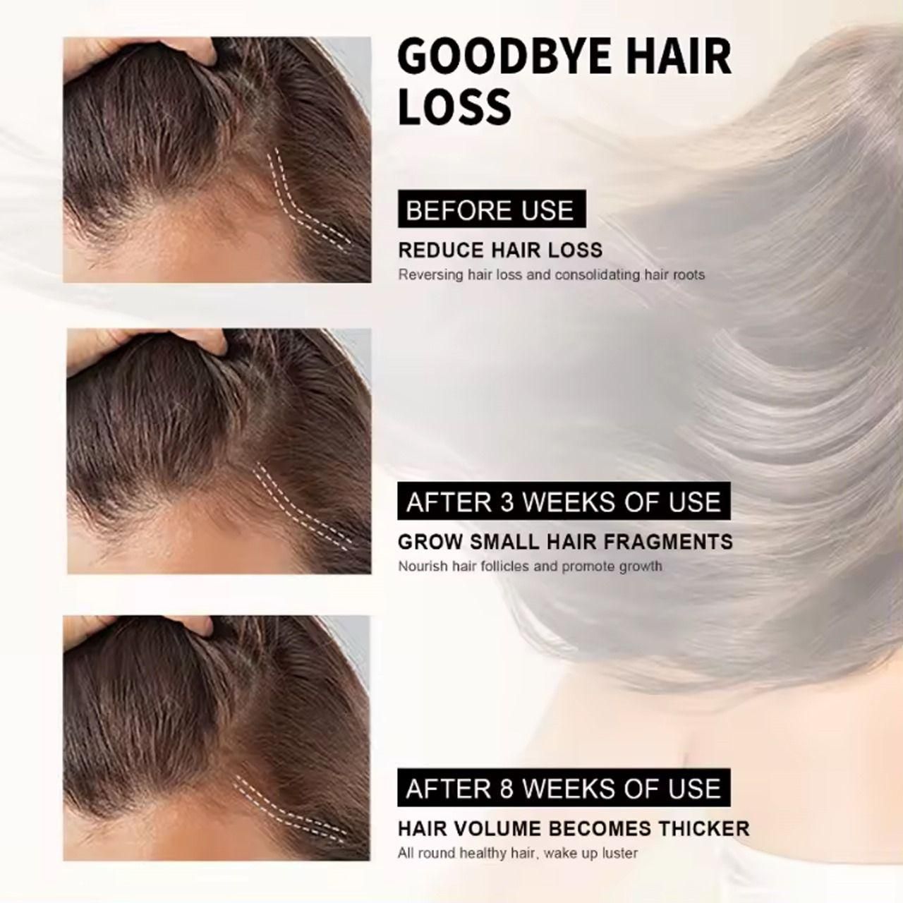 Hair Loss Treatment Serum 30ml (Pack of 2) – Boost Hair Growth & Strengthen Roots | NISHU Superstores
