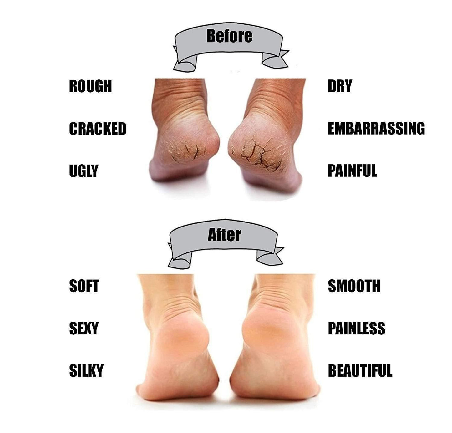 Silicon Gel Pad Heel Protector Socks – Pain Relief & Foot Care Support | NISHU Superstores