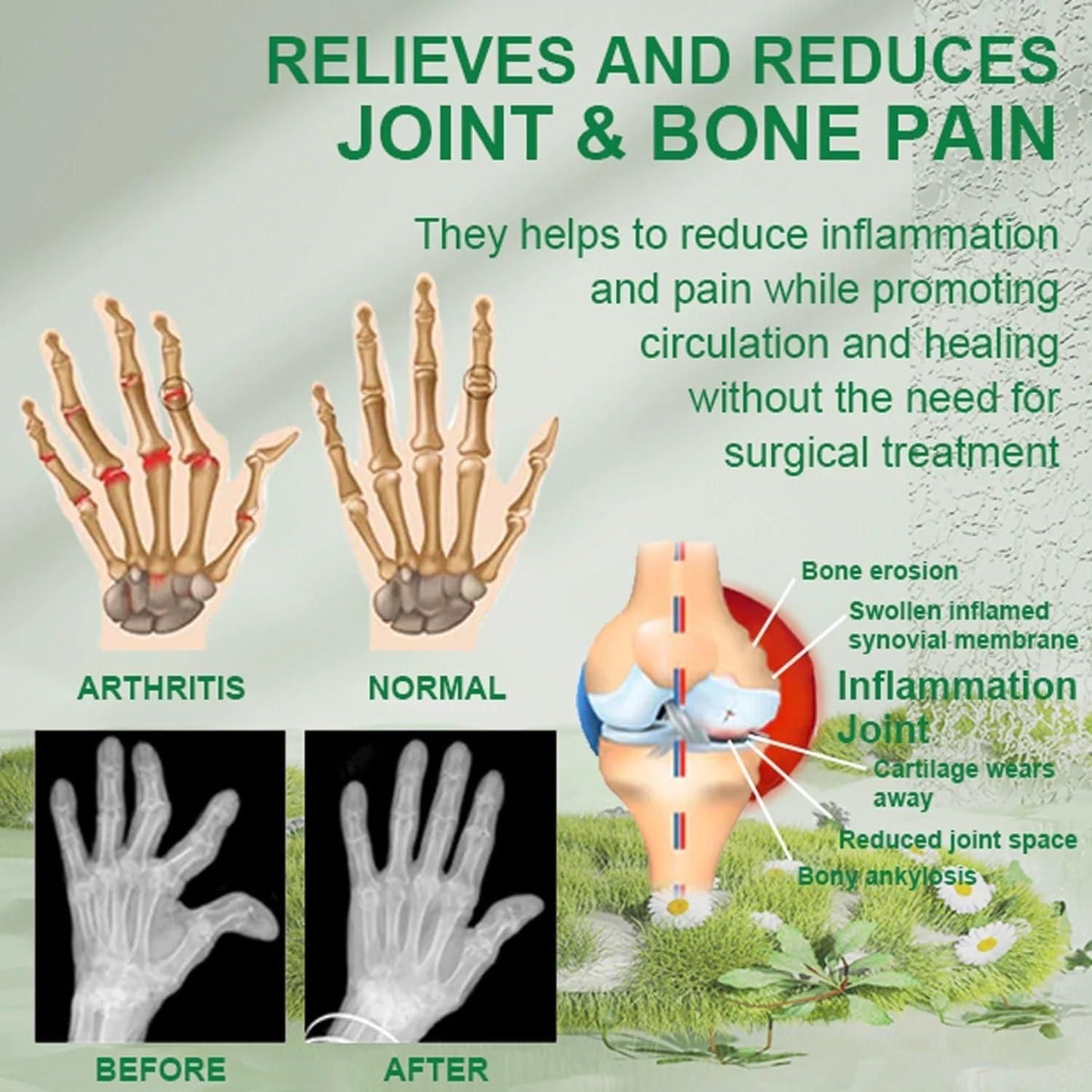Bee Venom Joint & Bone Therapy Cream 100gm – Natural Pain Relief for Joints & Muscles | NISHU Superstores