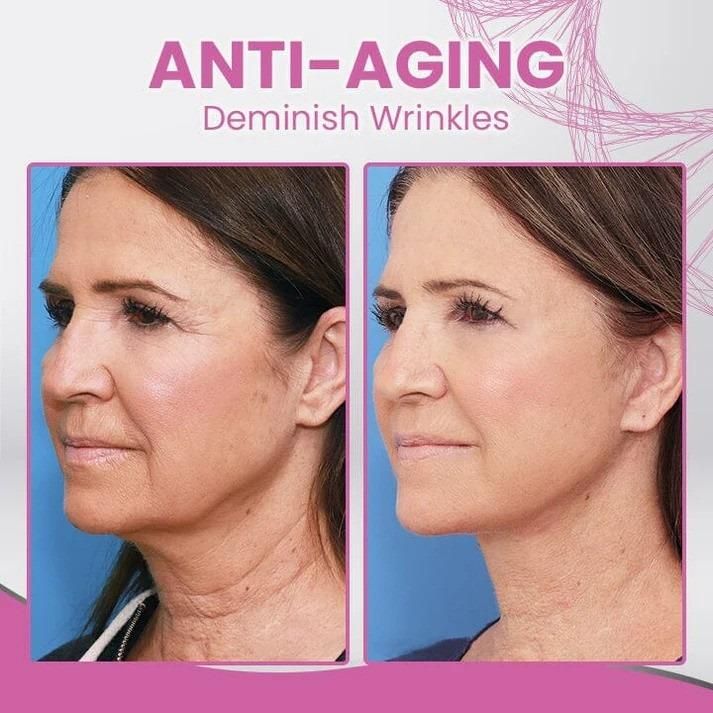 Caokerty Hydrolyzed Collagen Neck Cream 50g (Pack of 2) – Anti-Aging & Firming | NISHU Superstores
