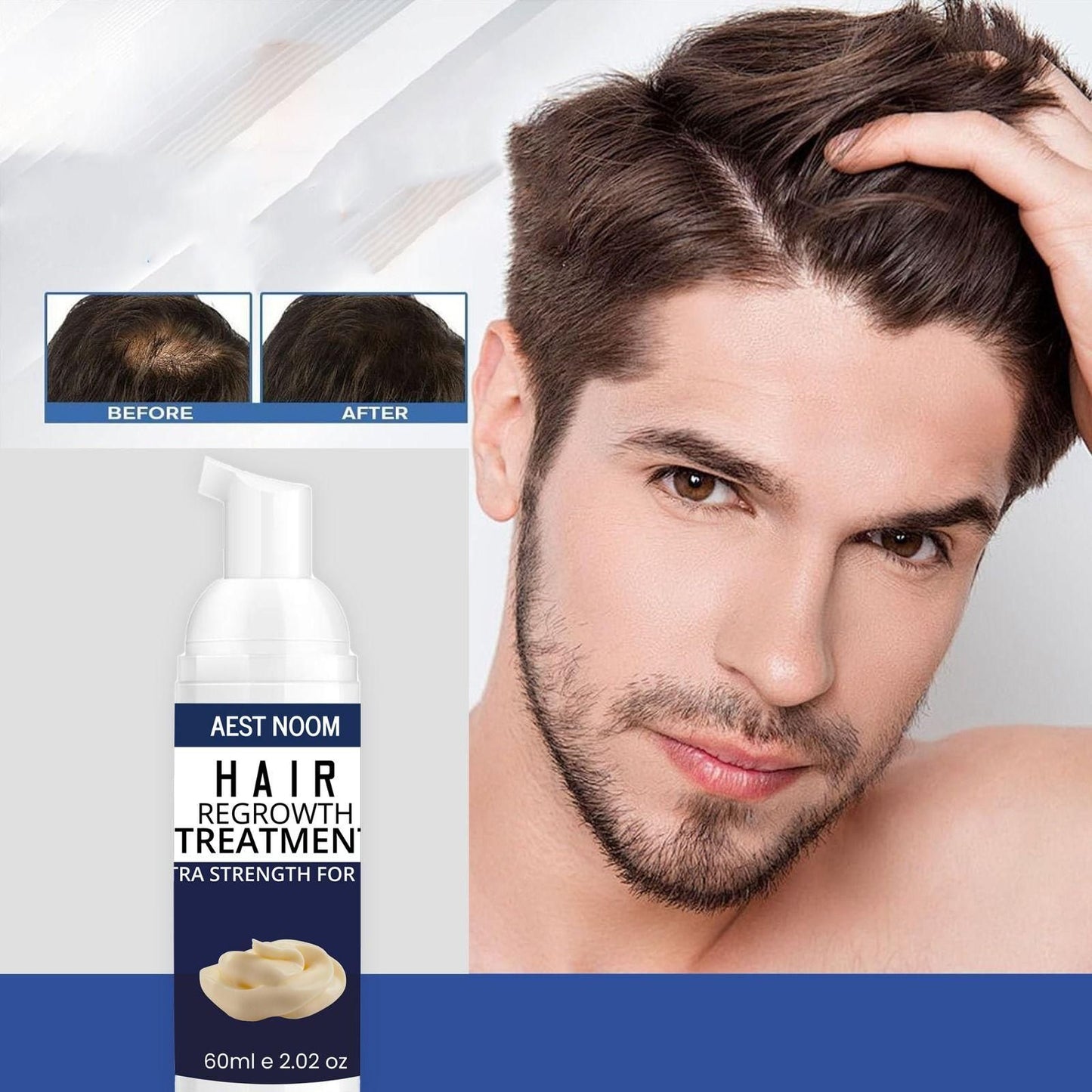 AEST NOOM Hair Regrowth Treatment – Extra Strength Formula 60ml | For Thicker, Fuller Hair | NISHU Superstores
