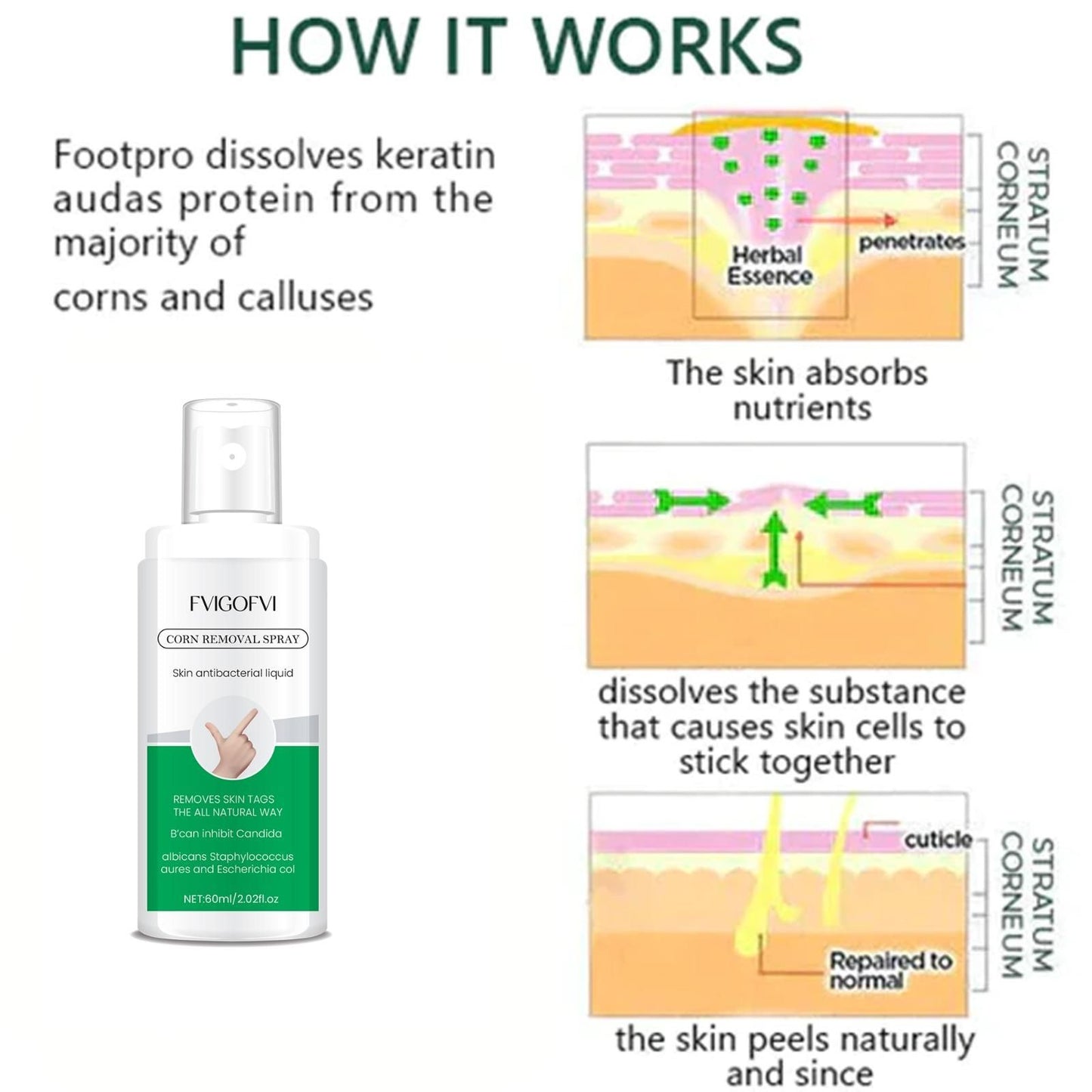 Corn Removal Spray 120ml (Pack of 2) – Fast & Effective Relief | NISHU Superstores
