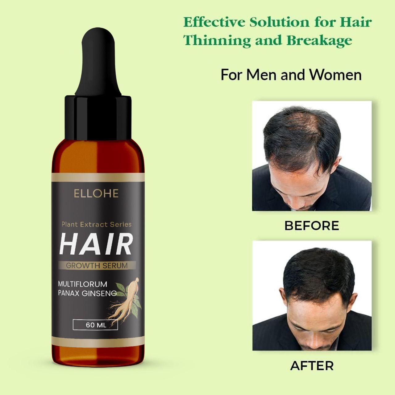 ELLOHE Hair Growth Castor Oil Spray – 120ml Pack of 2 for Hair Thickness & Regrowth | NISHU Superstores