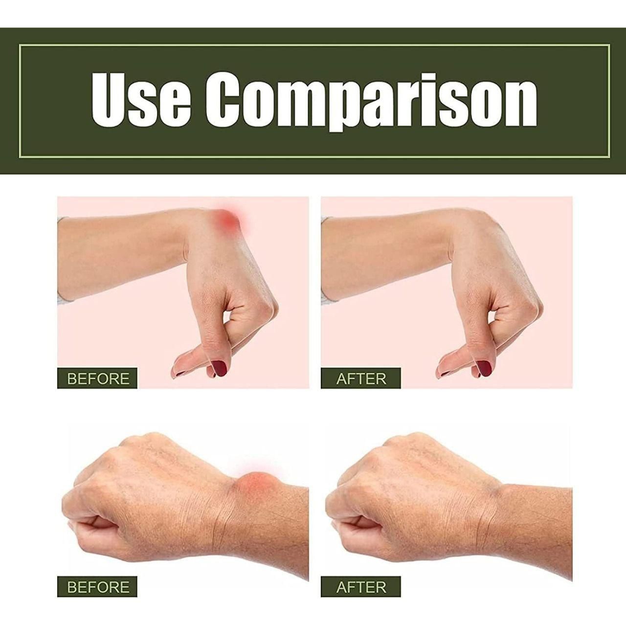 Principal Gu Tenosynovitis Cold Compress Gel – Pain Relief Formula (50ML, Pack of 2) | NISHU Superstores