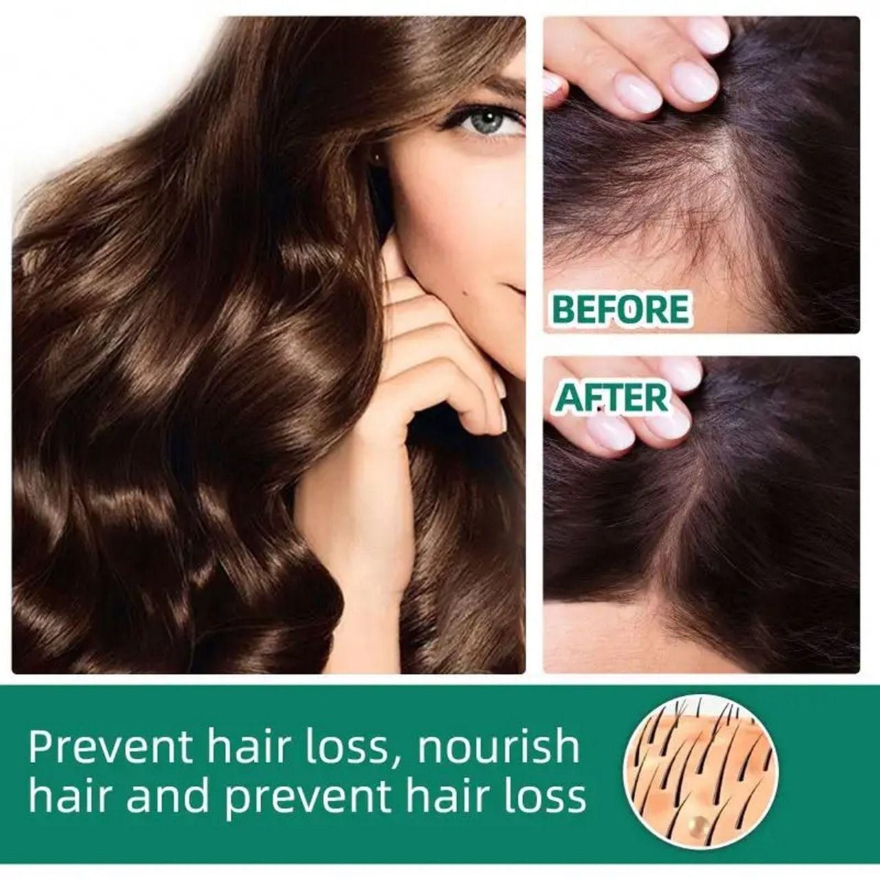 Wets & Months Hair Growth Essence – 120ml (Pack of 2) | Anti Hair Loss & Regrowth Serum | NISHU Superstores