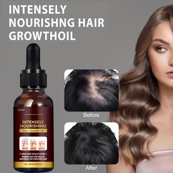 Intensely Nourishing Hair Growth Oil – 60ML (Pack of 2) | Boosts Growth & Reduces Hair Fall | NISHU Superstores