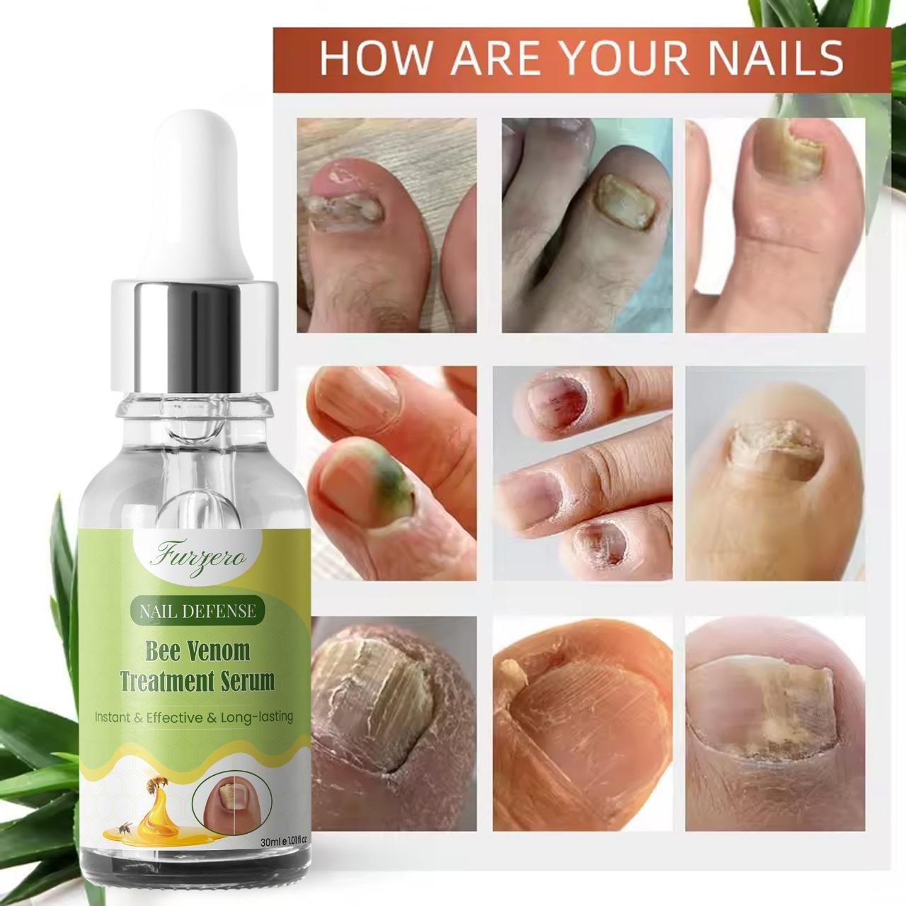 Furgero Nail Defense Bee Venom Serum 30ml – Anti-Fungal Nail Treatment | NISHU Superstores