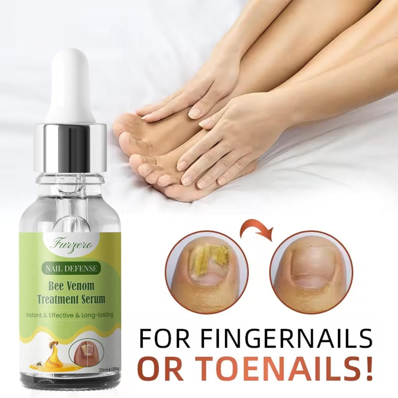 Furgero Nail Defense Bee Venom Serum 30ml – Anti-Fungal Nail Treatment | NISHU Superstores