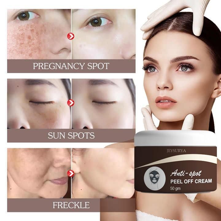 Anti-Spot Peel Off Cream 50g (Pack of 2) – Clear & Glowing Skin Solution | NISHU Superstores
