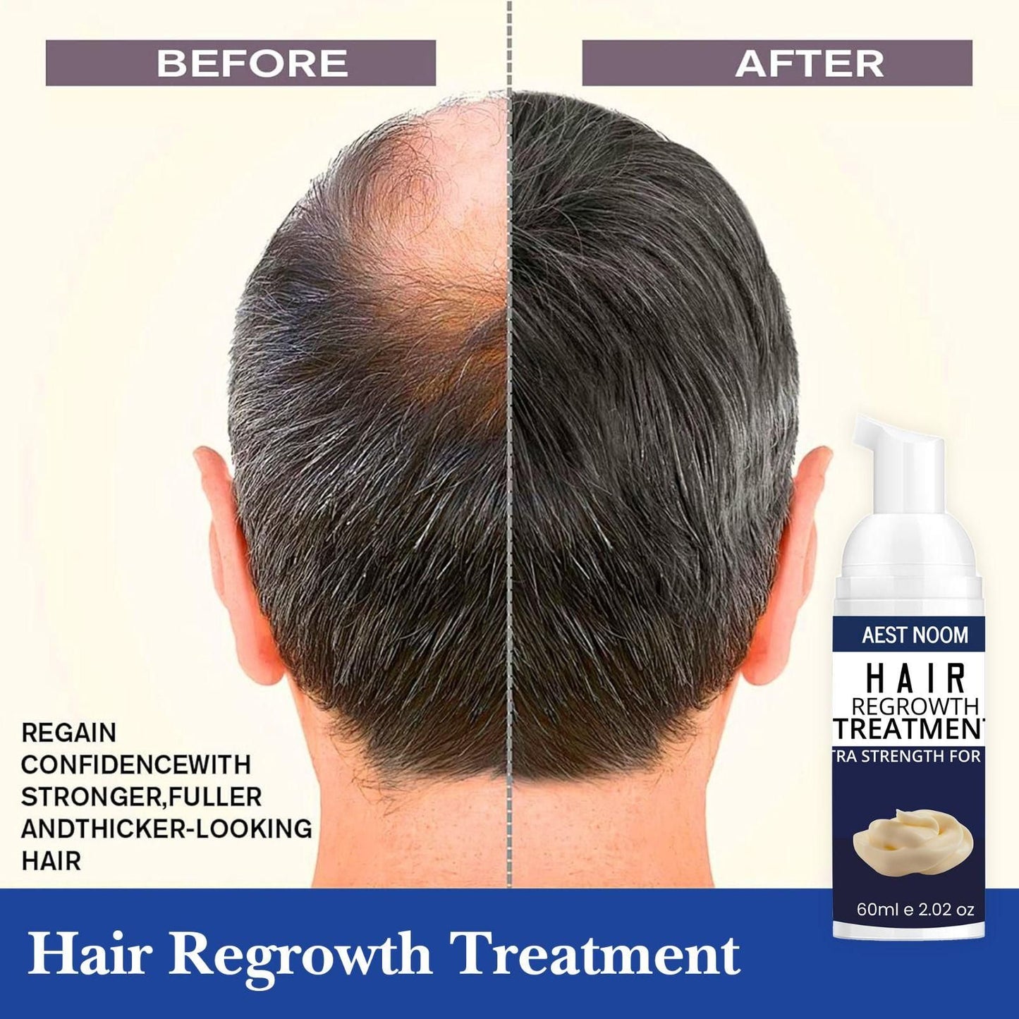 AEST NOOM Hair Regrowth Treatment – Extra Strength Formula 60ml | For Thicker, Fuller Hair | NISHU Superstores