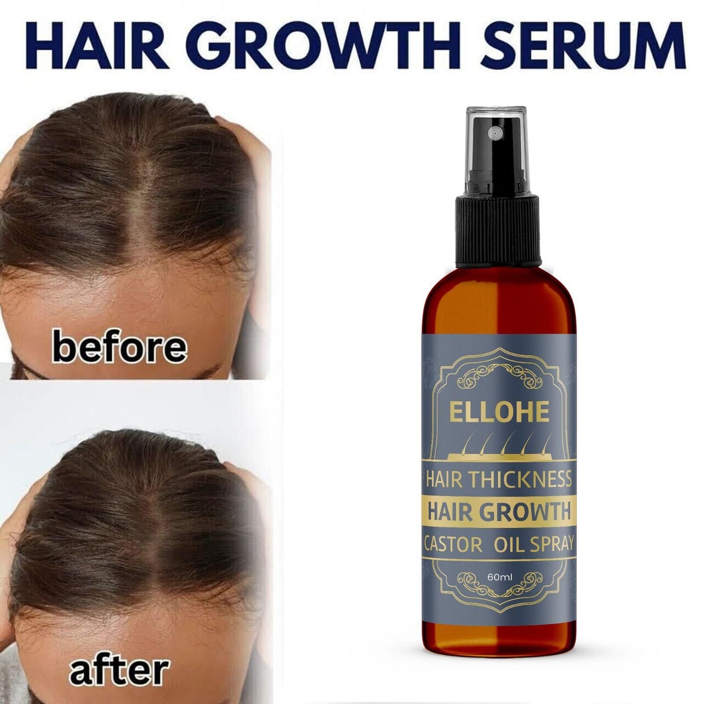 ELLOHE Hair Growth Castor Oil Spray – 120ml Pack of 2 for Hair Thickness & Regrowth | NISHU Superstores