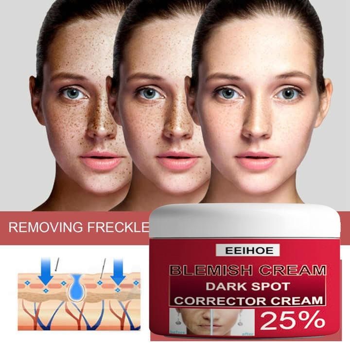 EEIHOE Blemish Cream Dark Spot Corrector – 50gm Pack of 2 | NISHU Superstores