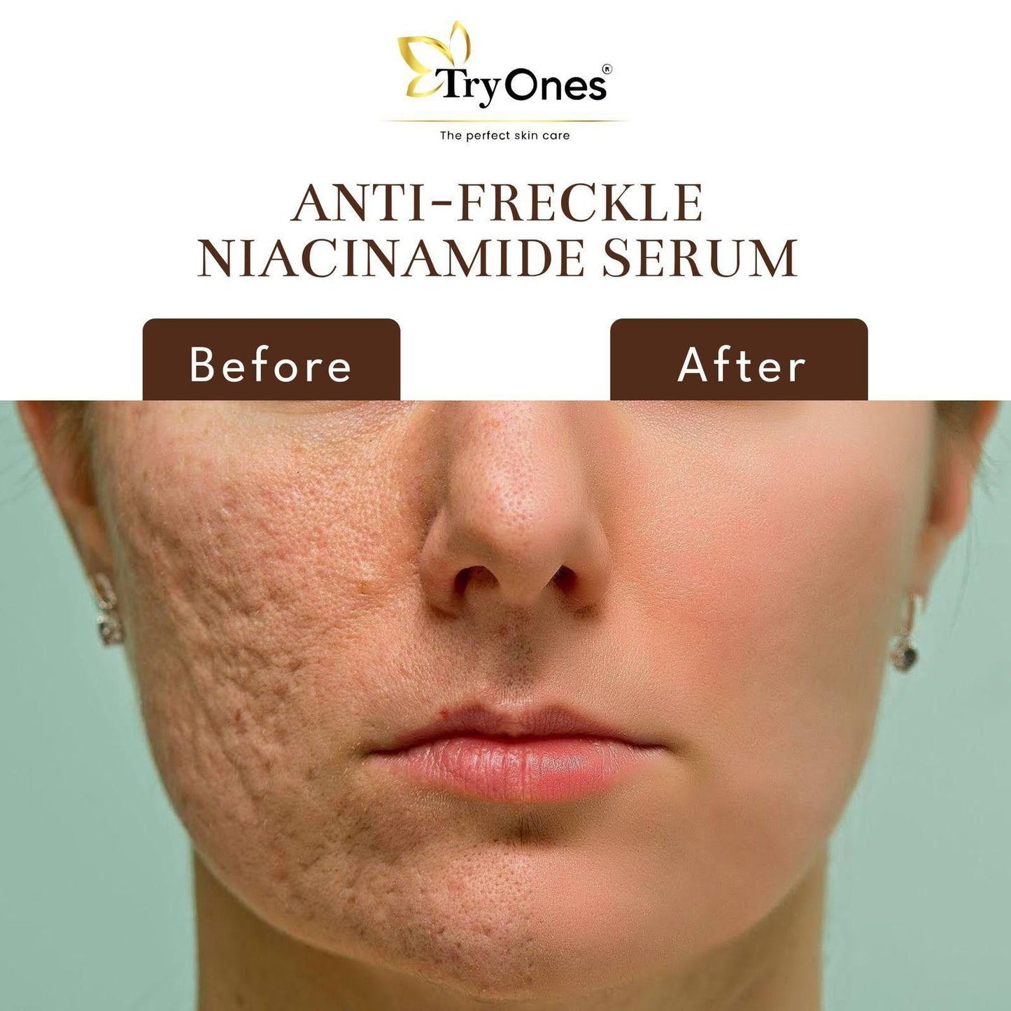 TryOnes Anti Freckle Niacinamide Face Serum 30ml – Spot Removal & Skin Brightening | NISHU Superstores