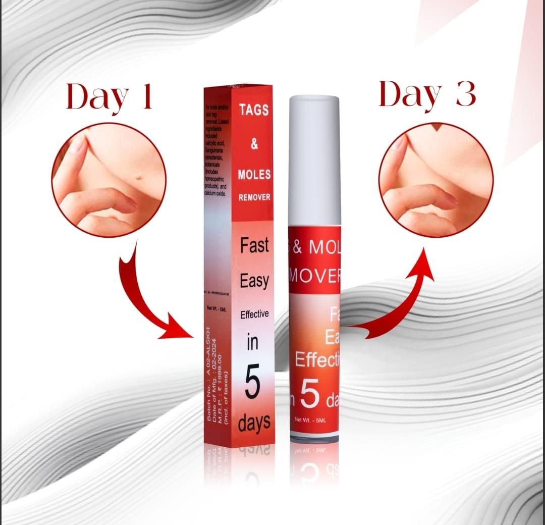 Skin Tags & Moles Remover – Pain-Free Treatment at Home | NISHU Superstores
