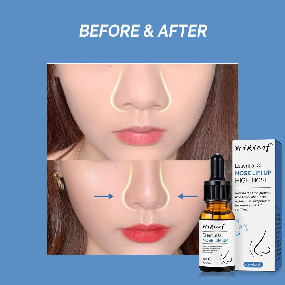 Peeling Oil for Dark Skin (Pack of 2, 50ml) – Skin Brightening & Exfoliating | NISHU Superstores