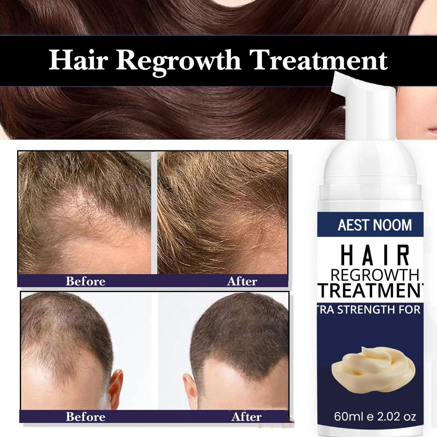 AEST NOOM Hair Regrowth Treatment – Extra Strength Formula 60ml | For Thicker, Fuller Hair | NISHU Superstores