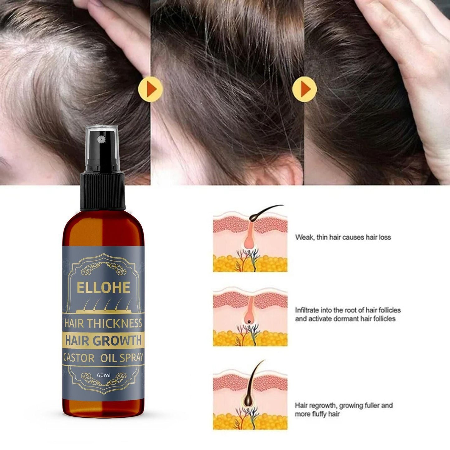 ELLOHE Hair Growth Castor Oil Spray – 120ml Pack of 2 for Hair Thickness & Regrowth | NISHU Superstores