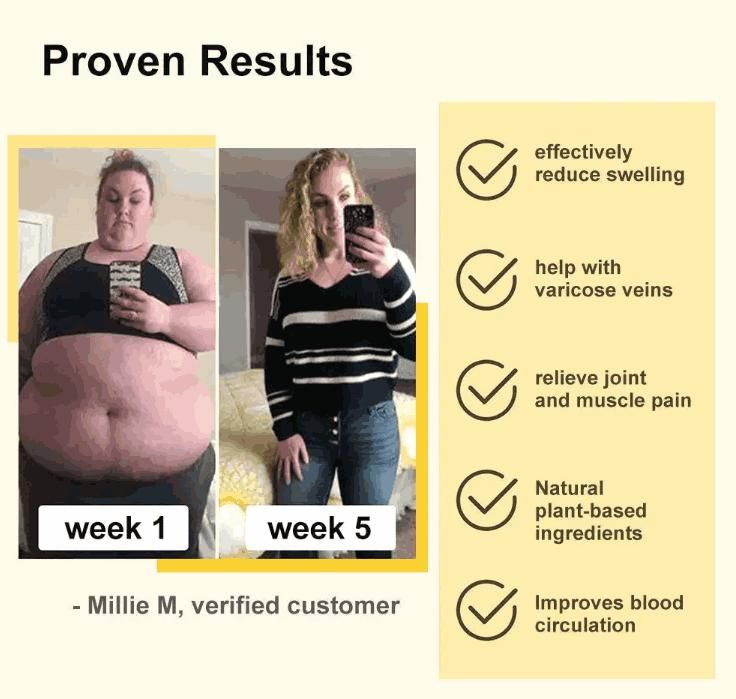Bee Venom Slimming & Lymphatic Drainage Patches (10 Pcs) – Detox & Fat Burn | NISHU Superstores