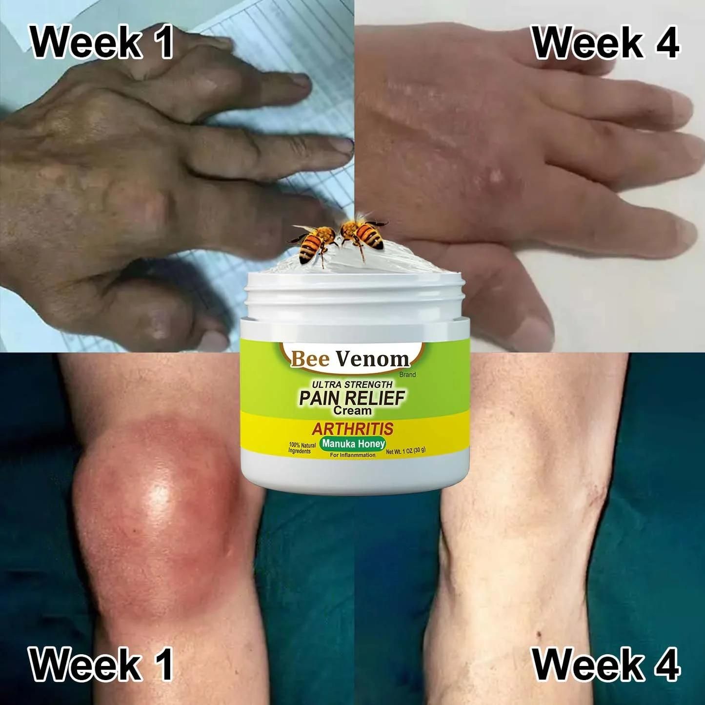 Bee Venom Joint & Bone Therapy Cream 100gm – Natural Pain Relief for Joints & Muscles | NISHU Superstores