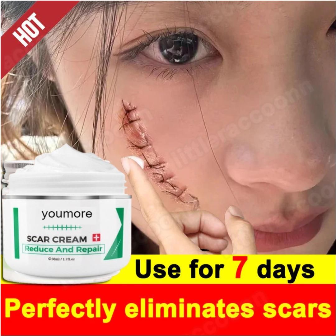 Scar Remover Stretch Mark Cream 50gm – Fade Scars & Stretch Marks Naturally | NISHU Superstores
