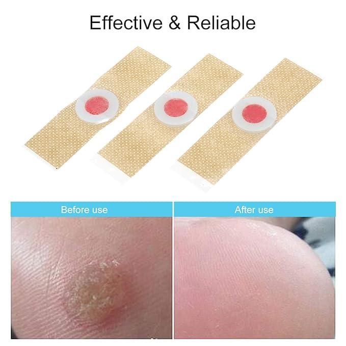 Corn Remover Pads – Pack of 24 | NISHU Superstores