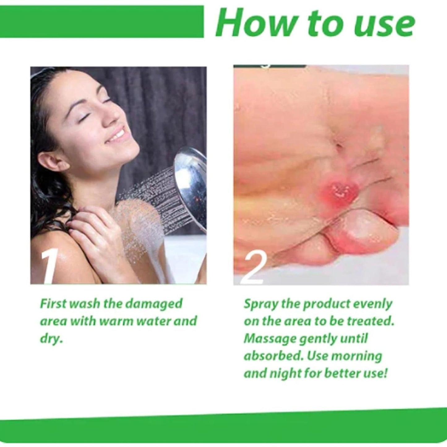 Corn Removal Spray 120ml (Pack of 2) – Fast & Effective Relief | NISHU Superstores