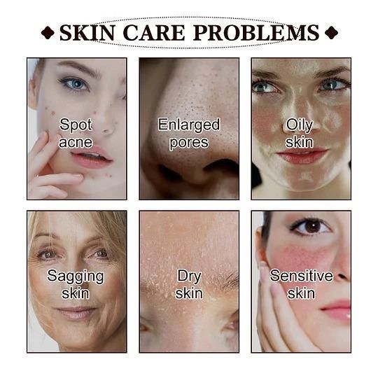 Black Team Face Mask 100g – Deep Cleansing & Glowing Skin | NISHU Superstores
