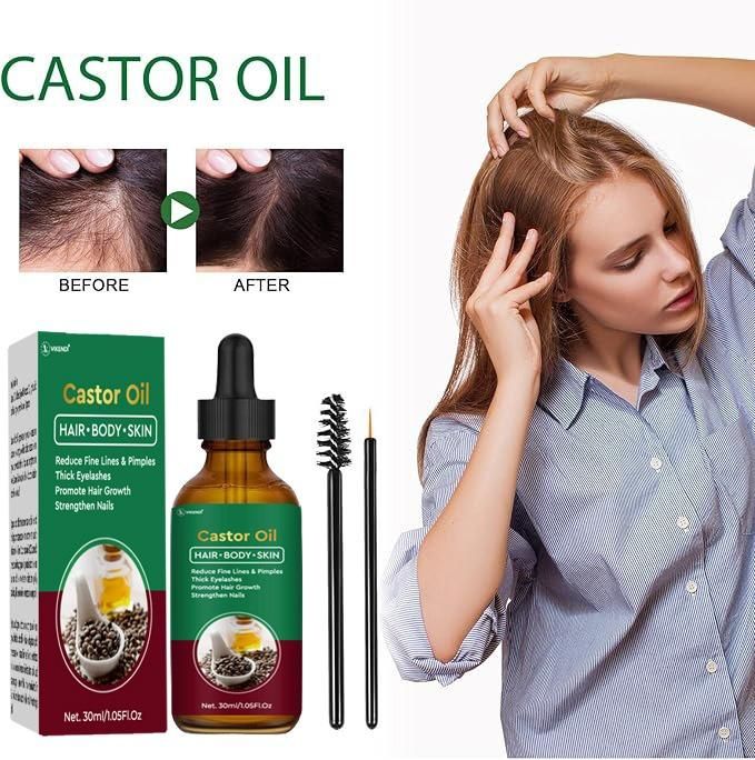 Castor Oil for Hair, Body & Skin (Pack of 1) – Pure & Natural Multipurpose Oil | NISHU Superstores