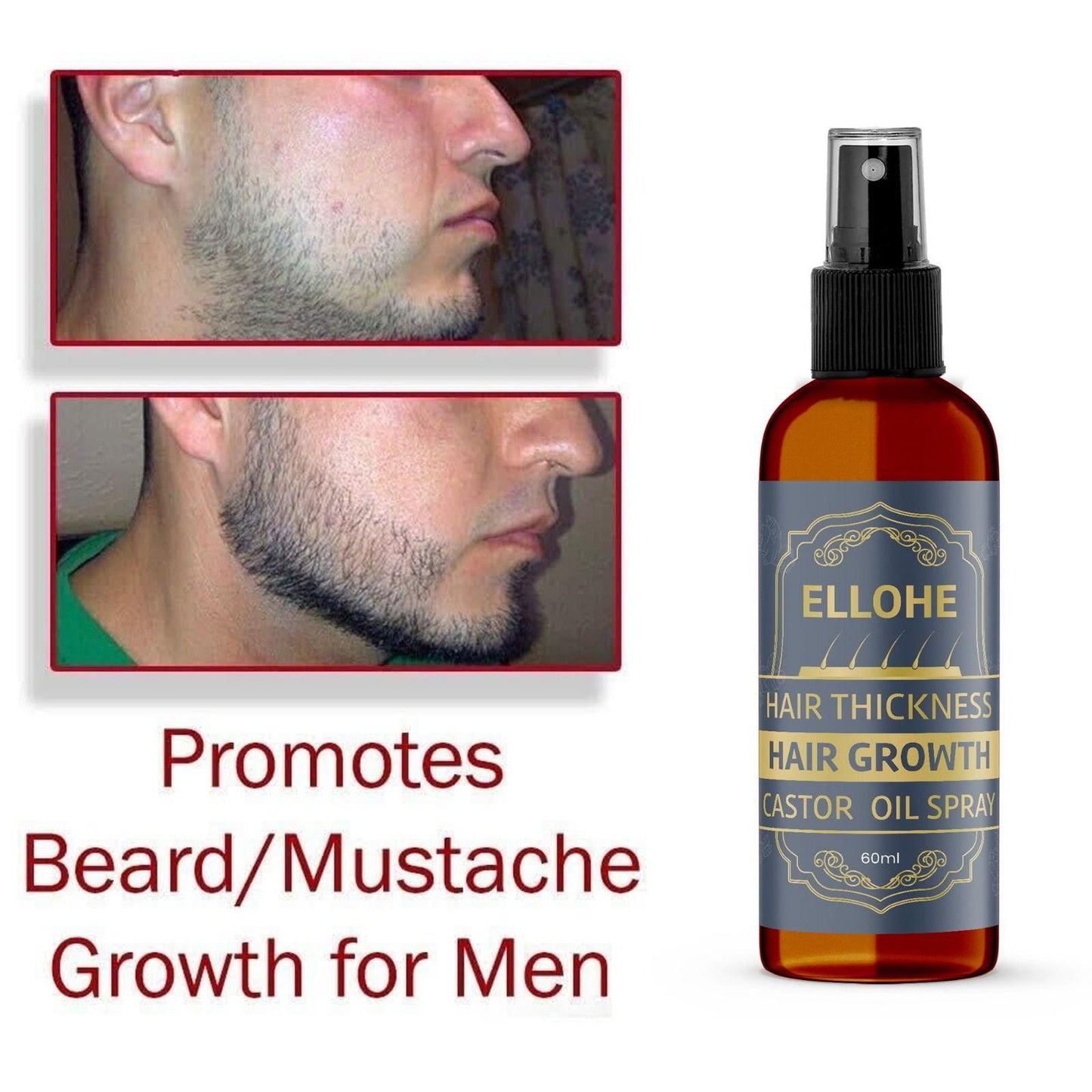 ELLOHE Hair Growth Castor Oil Spray – 60ml for Hair Thickness & Regrowth | NISHU Superstores