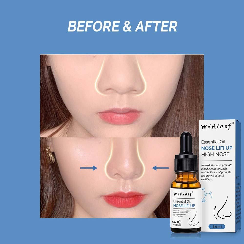 Nose Lifting Essential Oil – Sharp Nose Shape Naturally | 30ml | NISHU Superstores
