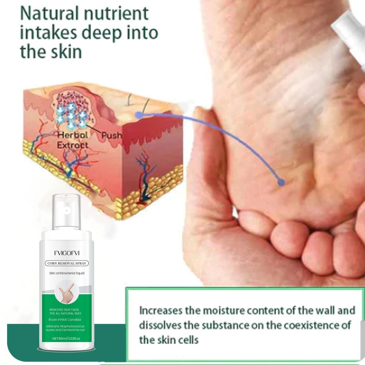 Corn Removal Spray 120ml (Pack of 2) – Fast & Effective Relief | NISHU Superstores