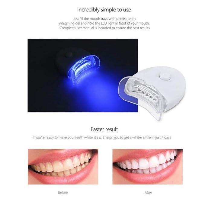 Teeth Cleaning & Whitening Kit – Brighten Your Smile at Home | NISHU Superstores