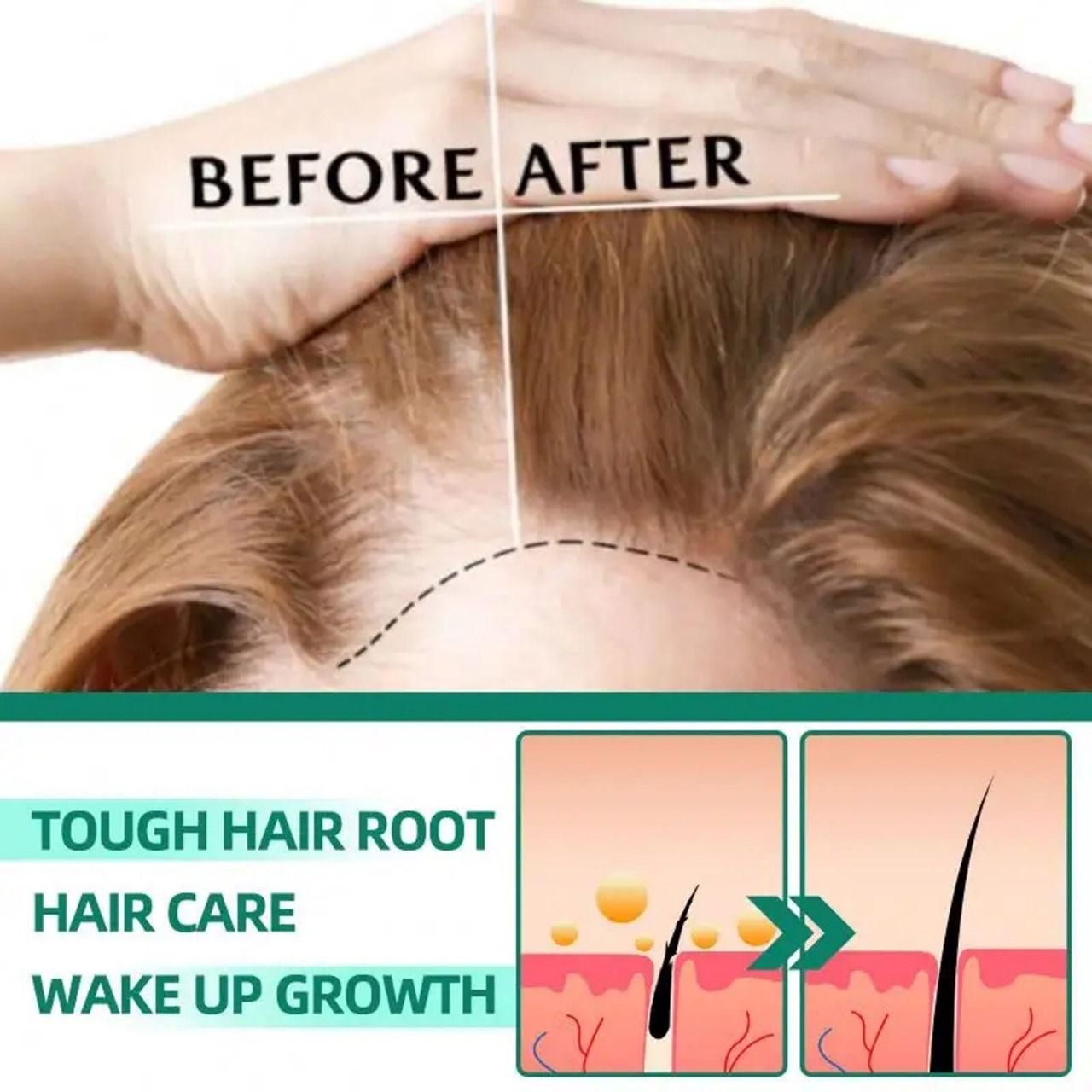 Wets & Months Hair Growth Essence – 120ml (Pack of 2) | Anti Hair Loss & Regrowth Serum | NISHU Superstores