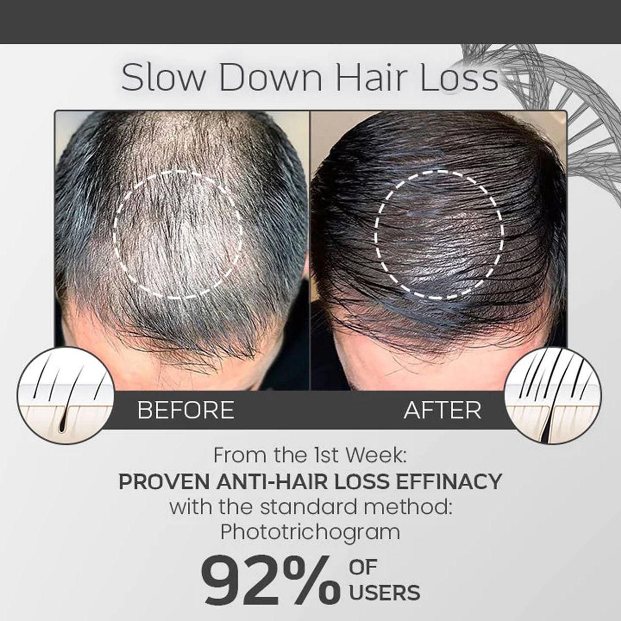 Esotery Shedd Stop Pro-Strength Hair Spray 100ml – Reduce Hair Fall & Strengthen Roots | NISHU Superstores