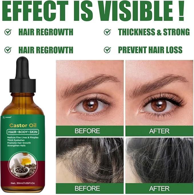 Castor Oil for Hair, Body & Skin (Pack of 1) – Pure & Natural Multipurpose Oil | NISHU Superstores